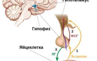 Поликистоз яичников — симптомы, причины