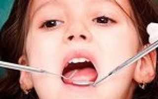 7 советов, которые помогут родителям вылечить кариес у ребенка