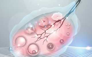 Самые распространенные причины бесплодия у женщин