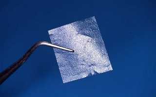 Использование титановых мембран для направленной костной регенерации