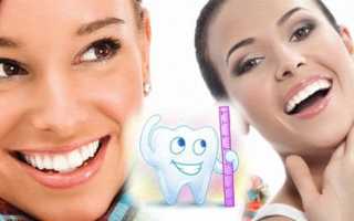 Как и чем лучше выровнять зубы в домашних условиях