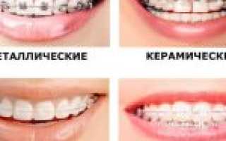 Окклюзионная плоскость в стоматологии