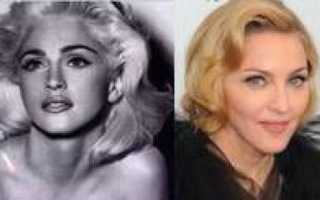 Почему худеет лицо с возрастом. Как сохранить молодость при похудении лица