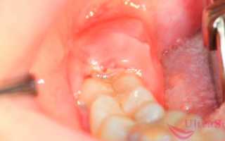 Болит голова и челюсть: все причины, которые к этому приводят