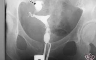 Современные методы диагностики бесплодия