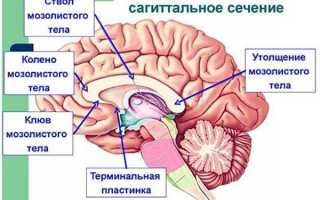Агенезия мозолистого тела (АМТ) у новорожденного, плода, детей. Что это такое, симптомы, последствия