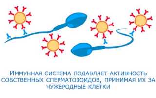 Когда иммунная система приводит к бесплодию