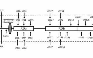 Причины бесплодия у мужчин генетические