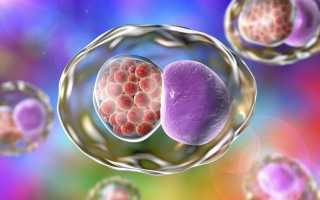 Хламидиоз-скрытая болезнь с опасными последствиям!