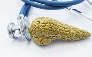 Синдром поликистозных яичников