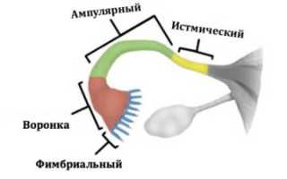 Женское бесплодие