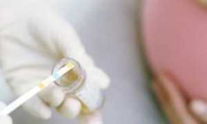 Гомоцистеин при планировании беременности