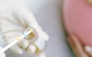 Гомоцистеин при планировании беременности