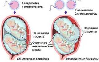 Как проводится экстракорпоральное оплодотворение