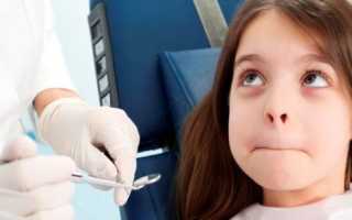 Фиссурный кариес: проявление и лечение