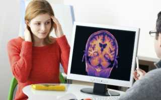 Рассеянный энцефаломиелит: симптомы заболевания и особенности терапии