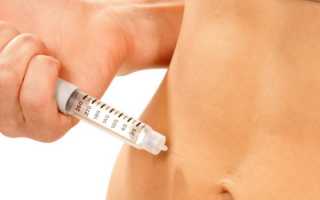 Где таятся опасности при ЭКО