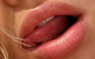 Стоматит — причины и симптомы