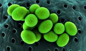 Лечение уреаплазмоза у женщин: симптомы, откуда берется и нужна ли терапия