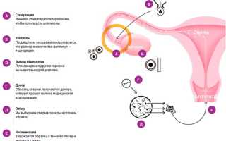 ЭКО с донорскими яйцеклетками