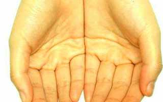 Желтеет кожа на руках и теле: как распознать серьезную патологию?