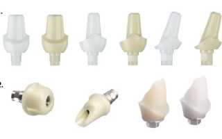 Применение компьютерных технологий для создания индивидуальных абатментов