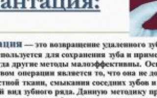 Реплантация (реваскуляризация) конечностей