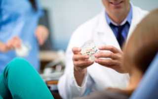 Целесообразность удаления зубов перед установкой брекетов и всегда ли это нужно