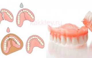 Кремы для фиксации зубных протезов при полном отсутствии зубов