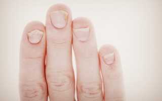 Василенко В.В., Виноградов Д.Л. Изменения ногтей при патологии пищеварительной системы // Новости медицинской фармации. – 2013. – Май. — № 9 (460). С. 16.