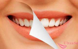 Отбеливание зубов с измененным цветом