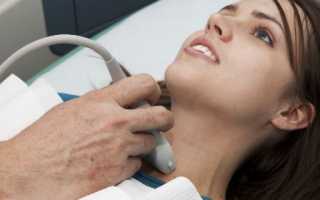 Профилактика бесплодия