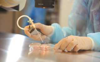 ЭКО клиники в Екатеринбурге