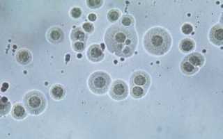 Анализ на выявление уреаплазмоза