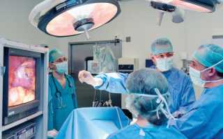 Маточные причины бесплодия