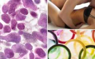 Уреаплазмоз и бесплодие