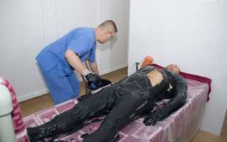 Санаторное лечение при бесплодии