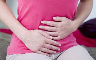 Кисты яичника