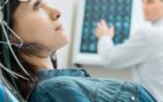 Электроэнцефалография головного мозга: показания, методика проведения