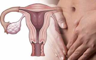 Молочница: симптомы у мужчин и женщин, лечение и профилактика